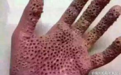密集恐惧症图片,视觉恐惧背后的心理奥秘